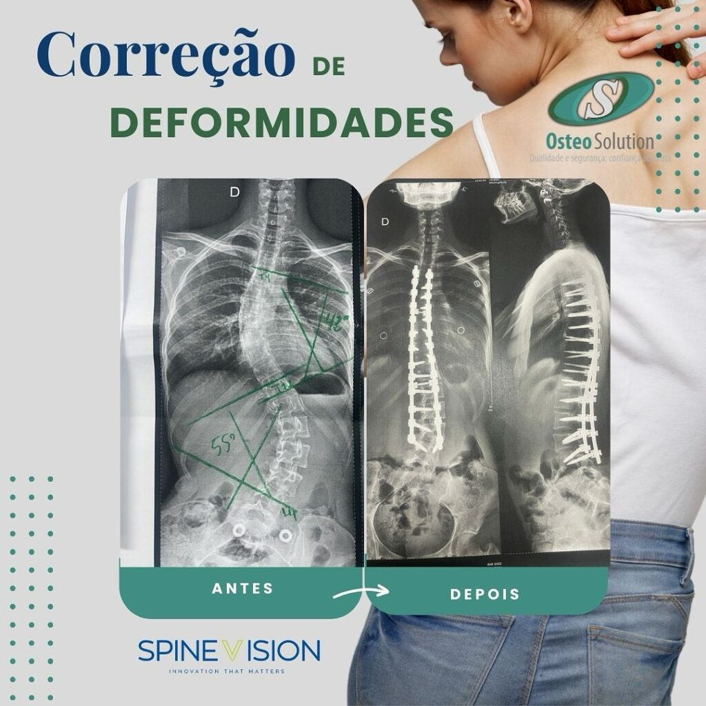 Instagram post from osteo_solution. This post is in position 16.