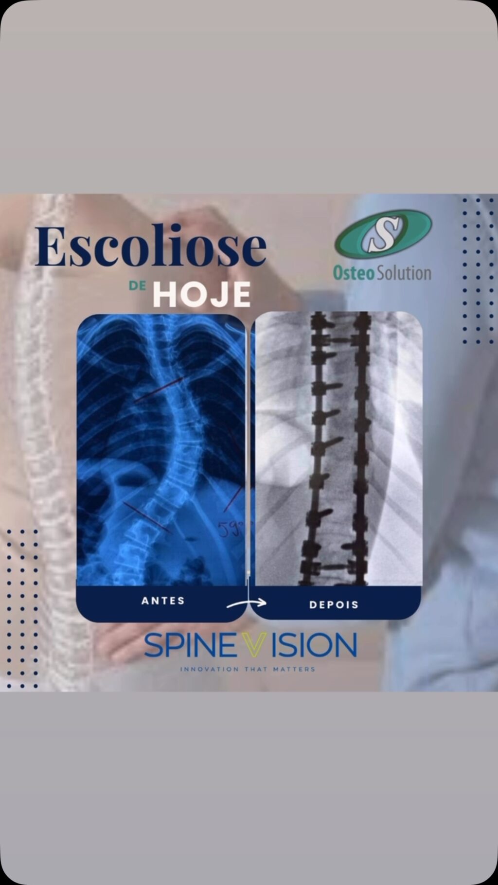 Instagram post from osteo_solution. This post is in position 7.