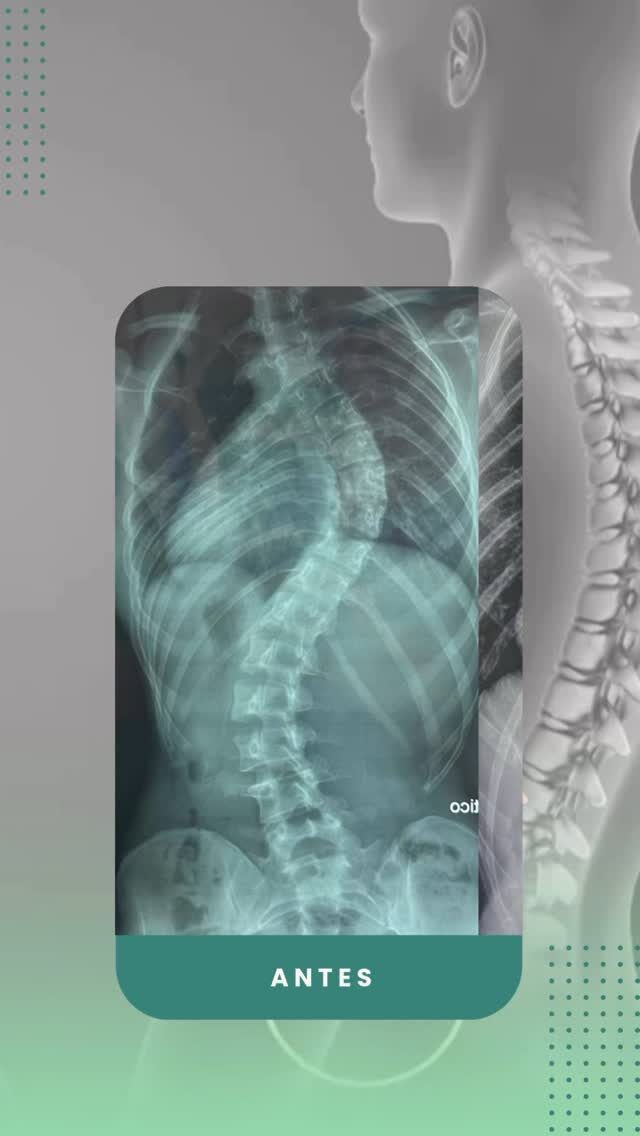 Instagram post from osteo_solution. This post is in position 11.