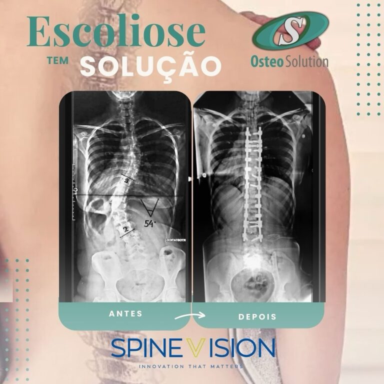 Instagram post from osteo_solution. This post is in position 12.